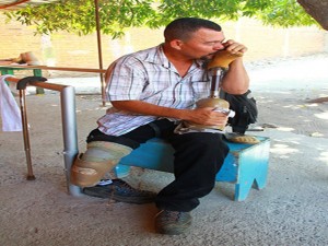 Norman Varela,  de Choluteca, Honduras besa su prótesis