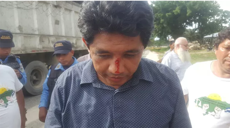 Medio ambiente, Martín Fernández