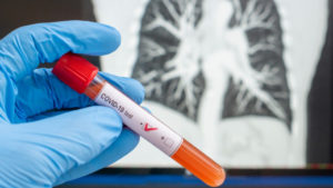 Rusia dona pruebas para covid-19