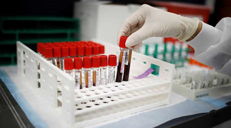 tercera vacuna rusa anticovid